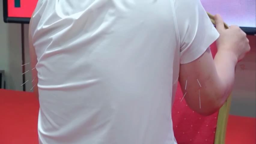 高血压，实战教学，操作视频，首次发布！