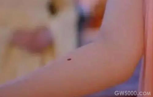 古代守宫砂真的管用吗？原理究竟是什么